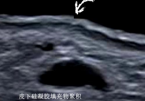 图片12